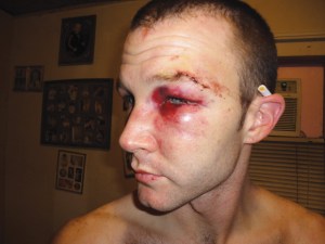 Burke-Burnett Burke-Burnett